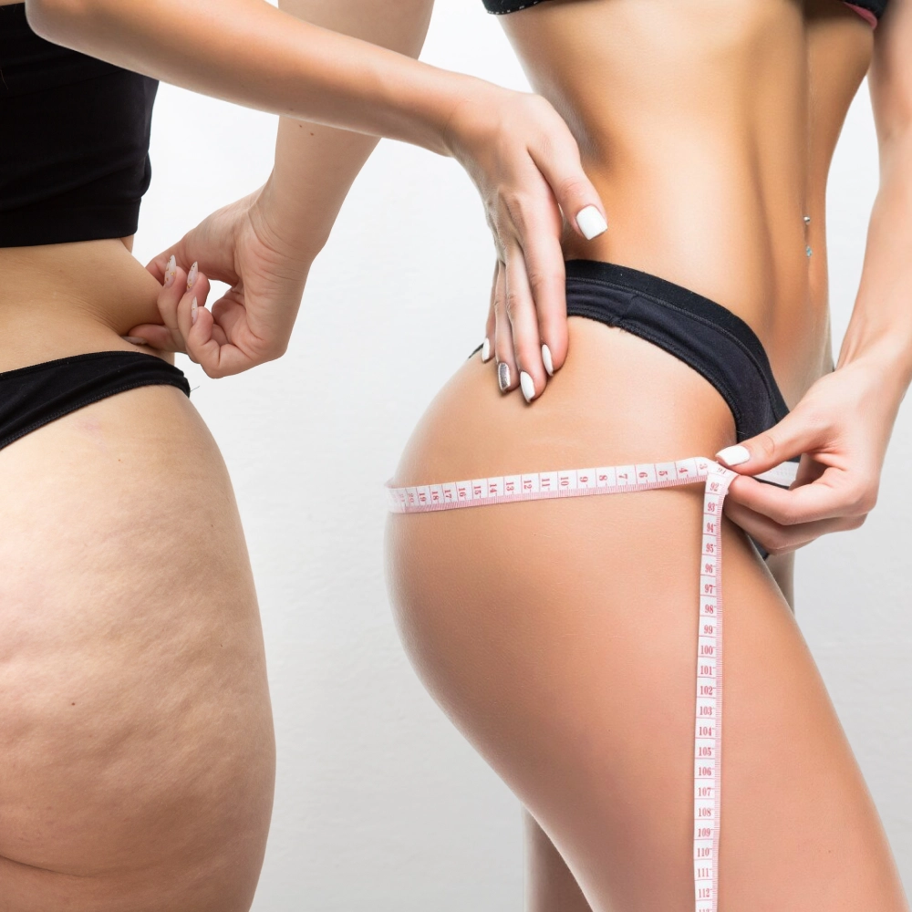 Как делать антицеллюлитный массаж дома: техника и приемы